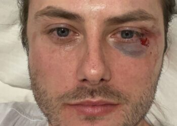 Man beaten in homophobic Tube attack ‘completely demoralised’ after no one stepped in to help