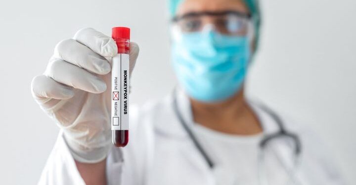 Montreal sauna suspected origin of Canada’s monkeypox outbreak: doctors Montreal sauna suspected origin of Canada’s monkeypox outbreak: doctors