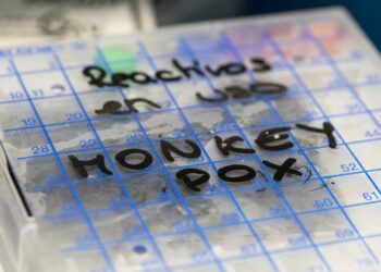 Expect first monkeypox cases in New Zealand by August – epidemiologist