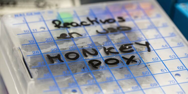 Expect first monkeypox cases in New Zealand by August – epidemiologist