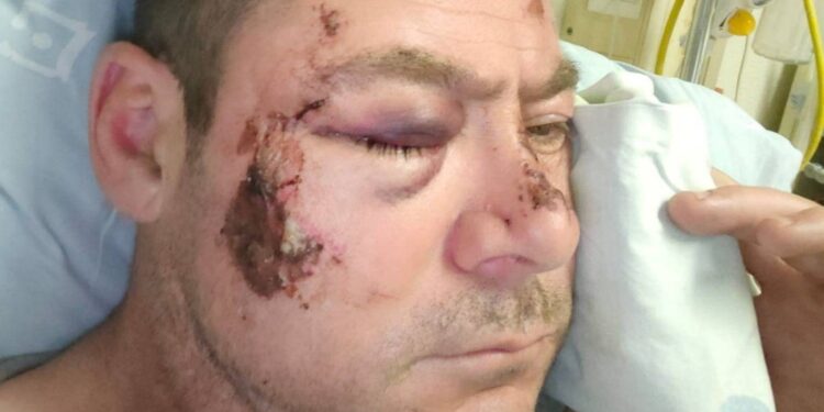 Former Springbok brutally attacked after South Africa’s win over All Blacks