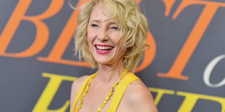 Anne Heche Is ‘Not Expected to Survive,’ Representative Says Anne Heche Is ‘Not Expected to Survive,’ Representative Says