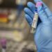 Monkeypox: Community transmission confirmed in New Zealand Monkeypox: Community transmission confirmed in New Zealand