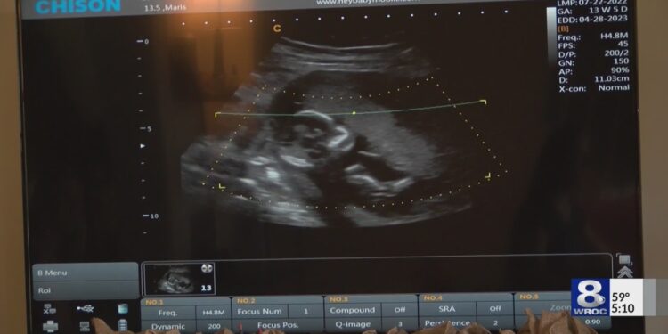 Mobile 4D ultrasound business in Rochester brings elective experience right to your home Mobile 4D ultrasound business in Rochester brings elective experience right to your home